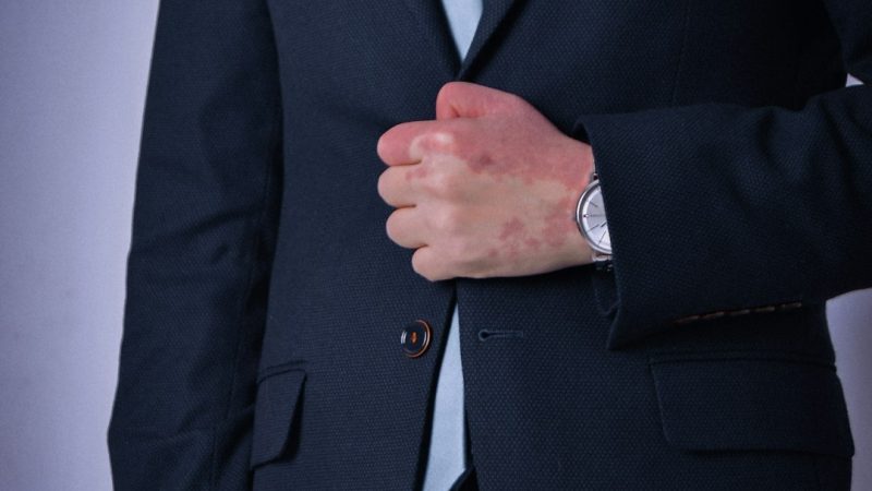 Регистрация патента через патентных юристов в Москве пошаговое руководство